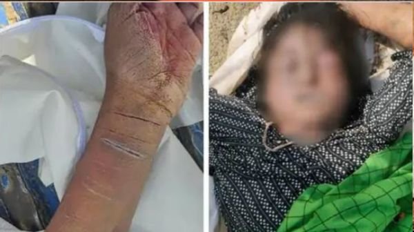 Kanpur: Young woman murdered, body found in a sack, 20 cut marks on wrist