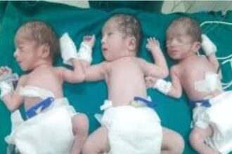 A woman gave birth to three children at once, mother and all three children are healthy