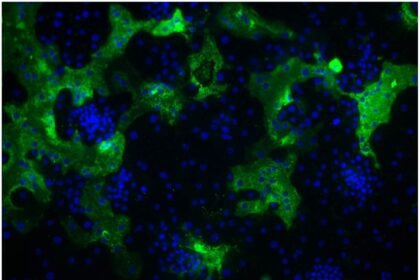 कोलकाता में HKU1 वायरस का पहला मामला सामने आया! जानें इस दुर्लभ कोरोनावायरस के लक्षण, फैलने का तरीका और बचाव के उपाय। पढ़ें पूरी जानकारी।"