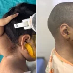 AIIMS Bhopal doctors news