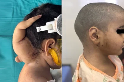 AIIMS Bhopal doctors news