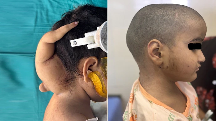 AIIMS Bhopal doctors news