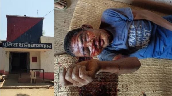 Jashpur: 15-year-old minor daughter killed her father and the mystery of blind murder was solved within 24 hours