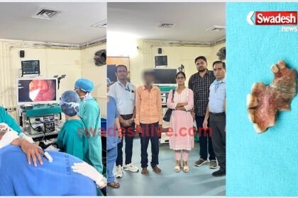 The teeth were stuck in the food pipe, the doctor at BMHRC removed them without surgery