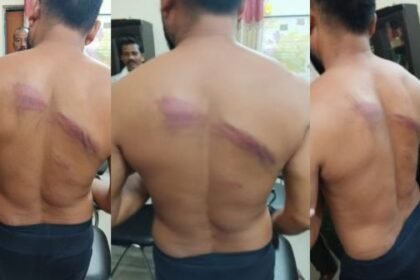 Bijapur: SDO and security personnel brutally beat up technical assistant and secretary for not giving way on the road