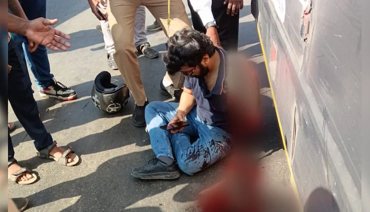 बस से टकराव में युवक का हाथ कटा