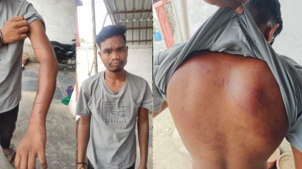 In Raigarh, a youth was held hostage for alcohol, tied to a tree and beaten up and ₹21,000 was stolen from his account