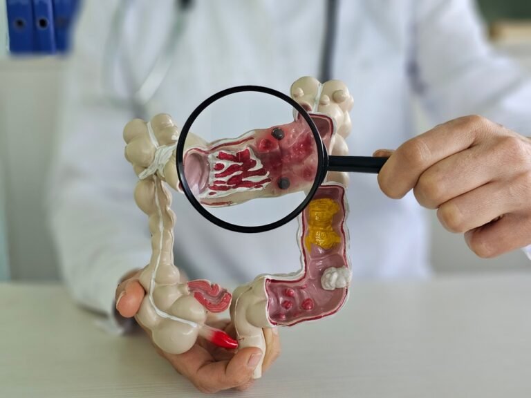 कोलन कैंसर