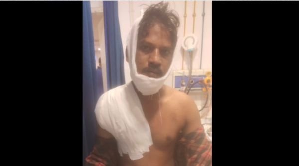 Accident in Bokaro Steel Plant, worker Dilip Manjhi narrowly escaped