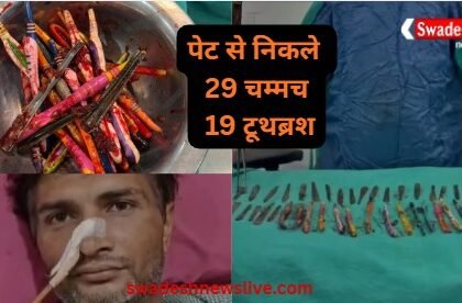 Hapur: 29 spoons, 19 toothbrushes, 2 pens found in young man's stomach, doctors were astonished
