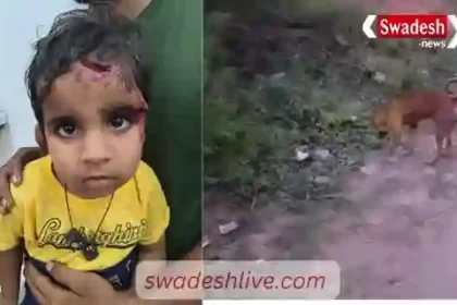 Gwalior: Stray dogs attack three-year-old child, seriously injured