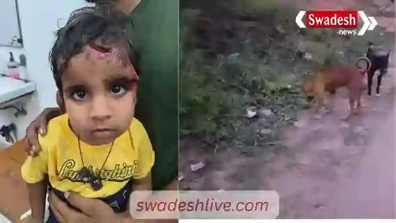 Gwalior: Stray dogs attack three-year-old child, seriously injured