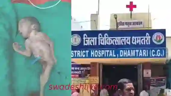 Miracle in Dhamtari: A 'mermaid-like child' was born