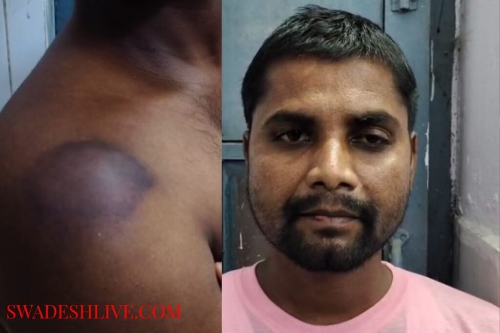 Forest officials in Pilibhit were accused of brutalizing a youth by holding him hostage.