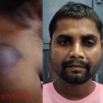 Forest officials in Pilibhit were accused of brutalizing a youth by holding him hostage.