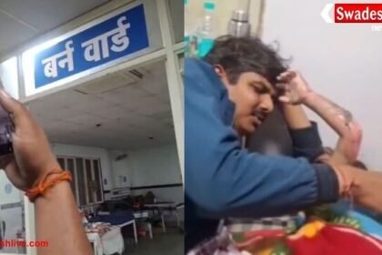 बागेश्वर धाम में 2 साल के बच्चा समोसे की कढ़ाई में गिरने से झुलसा