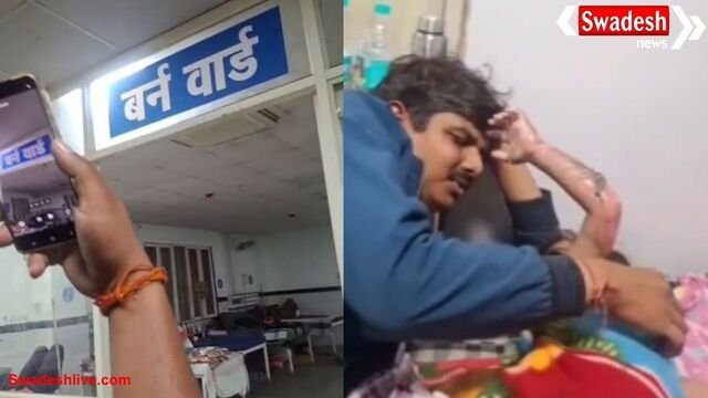 बागेश्वर धाम में 2 साल के बच्चा समोसे की कढ़ाई में गिरने से झुलसा