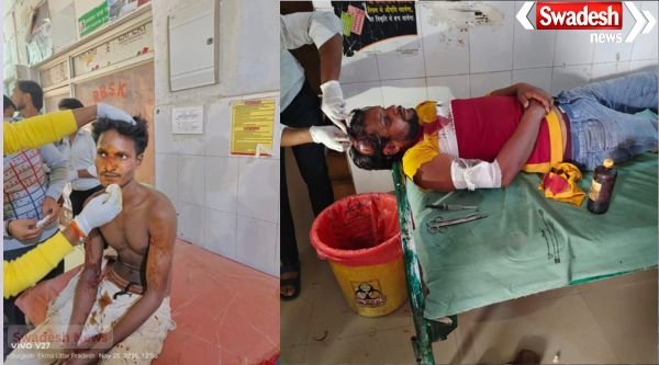 Leopard terror in Maharajganj: Goat grazing villagers attacked, five injured