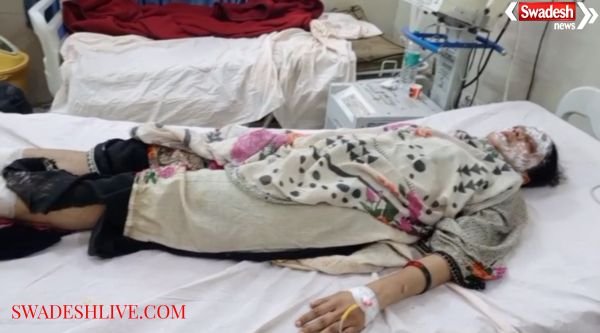 Mother and daughter burnt under suspicious circumstances in Firozabad