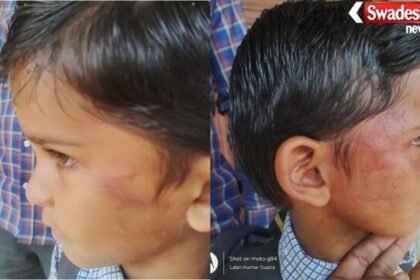 बलरामपुर: शराब के नशे में शिक्षक ने बच्चों को थप्पड़ मारे, बच्चा गंभीर रूप से घायल