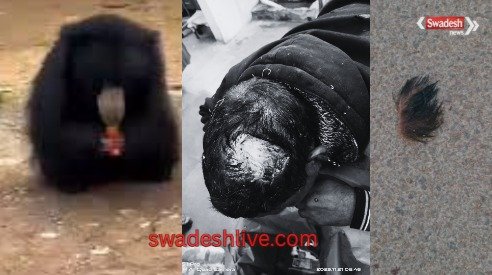 Bear attacks teacher during morning walk: Panic in Sarona, Forest Department and police on alert