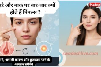Ayurvedic Medicine for Pimples