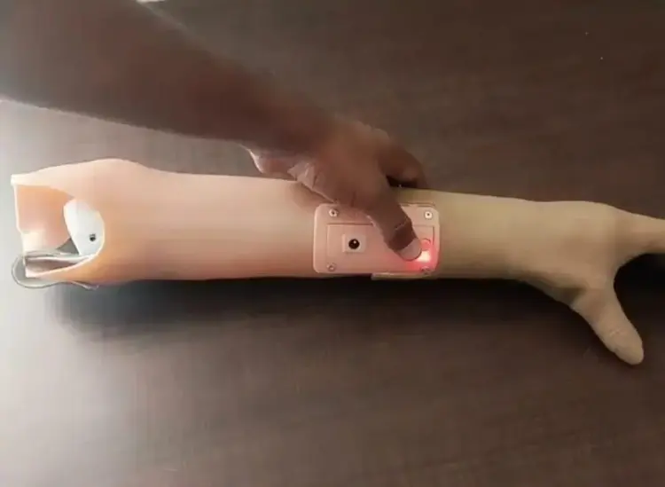 MP Prosthetic Hands