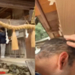 Hair loss
