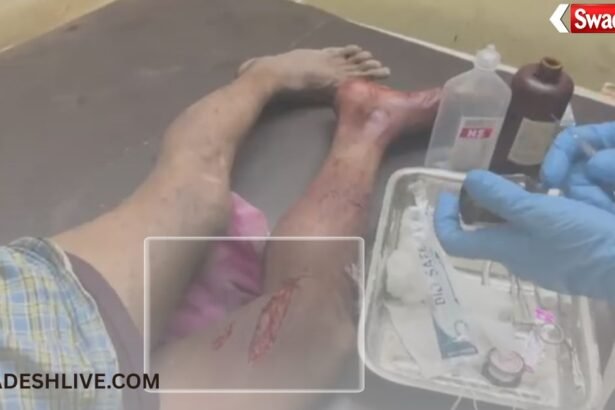 Monkey Terror: Monkey terror in Sakti, 18 people injured