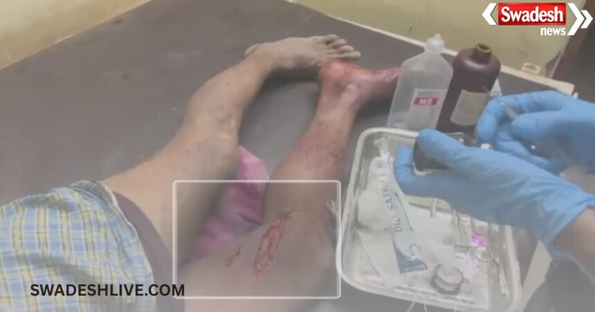 Monkey Terror: Monkey terror in Sakti, 18 people injured