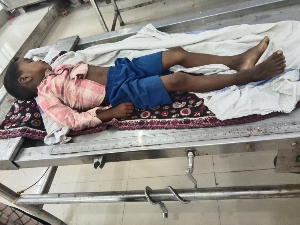 Snake Bite Death