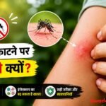 मच्छर के काटने के बाद खुजली करती हुई महिला।