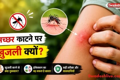मच्छर के काटने के बाद खुजली करती हुई महिला।