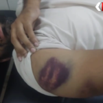Gorakhpur Police Brutality Case