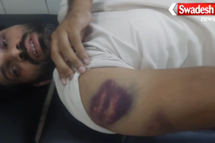 Gorakhpur Police Brutality Case