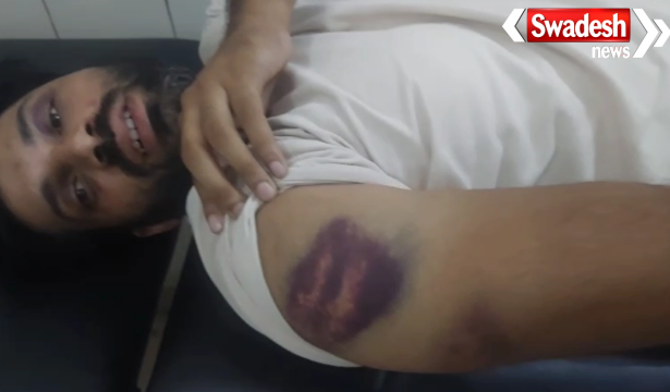 Gorakhpur Police Brutality Case