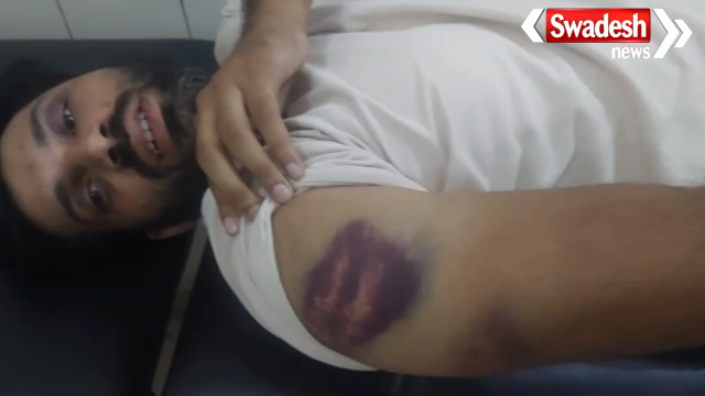 Gorakhpur Police Brutality Case