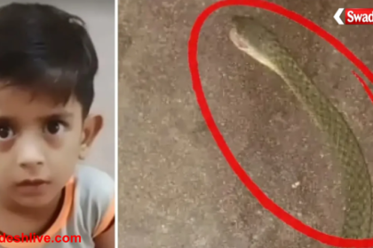 Snake Bite Child Kanpur